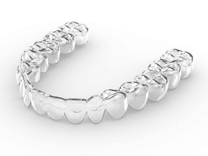 FS Aligners